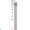 Fms Related Tyrosine Kinase 1 antibody, LS-C812377, Lifespan Biosciences, Western Blot image 