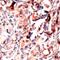 Ribosomal Protein S6 antibody, PA5-32581, Invitrogen Antibodies, Immunohistochemistry frozen image 
