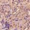 Adenylate Kinase 4 antibody, LS-C482345, Lifespan Biosciences, Immunohistochemistry frozen image 