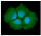 Adenylosuccinate Lyase antibody, GTX57653, GeneTex, Immunofluorescence image 