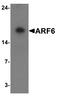ADP Ribosylation Factor 6 antibody, LS-C201193, Lifespan Biosciences, Western Blot image 
