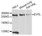 Envoplakin antibody, abx125827, Abbexa, Western Blot image 