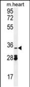 Oxidoreductase NAD Binding Domain Containing 1 antibody, PA5-48201, Invitrogen Antibodies, Western Blot image 