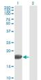 Fibroblast Growth Factor 1 antibody, H00002246-M02, Novus Biologicals, Western Blot image 