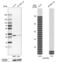 Kinetochore Localized Astrin (SPAG5) Binding Protein antibody, PA5-59828, Invitrogen Antibodies, Western Blot image 