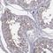 Speedy/RINGO Cell Cycle Regulator Family Member E4 antibody, NBP1-91055, Novus Biologicals, Immunohistochemistry paraffin image 