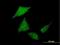 Serine/Threonine Kinase Like Domain Containing 1 antibody, H00169436-B01P, Novus Biologicals, Immunocytochemistry image 