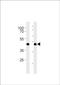 G Protein-Coupled Receptor 68 antibody, PA5-49323, Invitrogen Antibodies, Western Blot image 