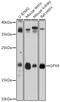 Glutathione Peroxidase 4 antibody, GTX54095, GeneTex, Western Blot image 