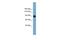 Apoptosis Resistant E3 Ubiquitin Protein Ligase 1 antibody, A13086, Boster Biological Technology, Western Blot image 