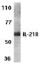 Interleukin-21 receptor antibody, 40105, QED Bioscience, Western Blot image 