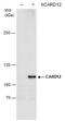 NLR family CARD domain-containing protein 4 antibody, PA5-27686, Invitrogen Antibodies, Western Blot image 