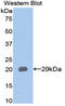 Mucin 5AC, Oligomeric Mucus/Gel-Forming antibody, LS-C304835, Lifespan Biosciences, Western Blot image 