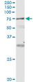 Vacuolar protein sorting-associated protein 18 homolog antibody, LS-C139435, Lifespan Biosciences, Immunoprecipitation image 