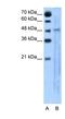 Solute carrier family 25 member 46 antibody, NBP1-59565, Novus Biologicals, Western Blot image 