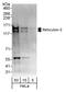 Reticulon 3 antibody, A302-860A, Bethyl Labs, Western Blot image 