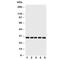 Stratifin antibody, R30895, NSJ Bioreagents, Western Blot image 