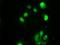 Checkpoint Kinase 2 antibody, NBP1-47695, Novus Biologicals, Immunofluorescence image 