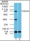 Forkhead Box O3 antibody, orb87662, Biorbyt, Western Blot image 