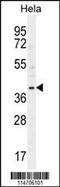 Cyclin-G1 antibody, 55-520, ProSci, Western Blot image 