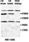 Plexin B1 antibody, orb76910, Biorbyt, Western Blot image 