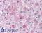 Glucagon Receptor antibody, LS-A4263, Lifespan Biosciences, Immunohistochemistry paraffin image 