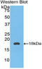 Coagulation Factor IX antibody, LS-C300266, Lifespan Biosciences, Western Blot image 