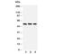 Checkpoint Kinase 1 antibody, R30517, NSJ Bioreagents, Western Blot image 