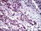 FLI1 antibody, NBP2-37359, Novus Biologicals, Immunohistochemistry paraffin image 