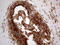 Hyaluronan Binding Protein 2 antibody, LS-C799037, Lifespan Biosciences, Immunohistochemistry paraffin image 