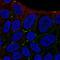 Eva1 antibody, NBP2-31836, Novus Biologicals, Immunocytochemistry image 