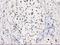 p53 antibody, LS-C172912, Lifespan Biosciences, Immunohistochemistry paraffin image 