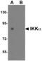 Component Of Inhibitor Of Nuclear Factor Kappa B Kinase Complex antibody, 2115, QED Bioscience, Western Blot image 