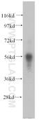 Coronin 1C antibody, 14749-1-AP, Proteintech Group, Western Blot image 