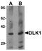 Delta Like Non-Canonical Notch Ligand 1 antibody, A00513, Boster Biological Technology, Western Blot image 