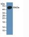 Estrogen Receptor 2 antibody, LS-C663162, Lifespan Biosciences, Western Blot image 