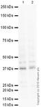 Survival Of Motor Neuron 2, Centromeric antibody, ab5831, Abcam, Western Blot image 