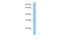 SRY-Box 8 antibody, 27-240, ProSci, Western Blot image 