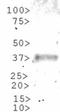 GLI Family Zinc Finger 1 antibody, NBP1-78259, Novus Biologicals, Western Blot image 