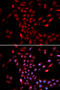 Karyopherin Subunit Alpha 4 antibody, A05188-1, Boster Biological Technology, Western Blot image 