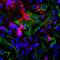 TACO antibody, NB110-58867, Novus Biologicals, Immunocytochemistry image 