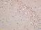 Cereblon antibody, orb156449, Biorbyt, Immunohistochemistry paraffin image 