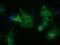 Histone Deacetylase 6 antibody, MA5-25317, Invitrogen Antibodies, Immunocytochemistry image 