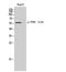 Tryptophan Hydroxylase 2 antibody, A01643S19, Boster Biological Technology, Western Blot image 