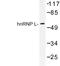 Heterogeneous Nuclear Ribonucleoprotein L antibody, LS-C176733, Lifespan Biosciences, Western Blot image 