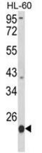 Proteasome Subunit Beta 9 antibody, GTX81175, GeneTex, Western Blot image 