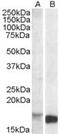 Translocator protein antibody, MBS421649, MyBioSource, Western Blot image 