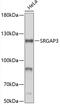 SLIT-ROBO Rho GTPase Activating Protein 3 antibody, 19-351, ProSci, Western Blot image 