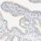 Mannosidase Endo-Alpha antibody, NBP1-82279, Novus Biologicals, Immunohistochemistry frozen image 