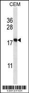 Eukaryotic Translation Initiation Factor 5A2 antibody, 57-447, ProSci, Western Blot image 